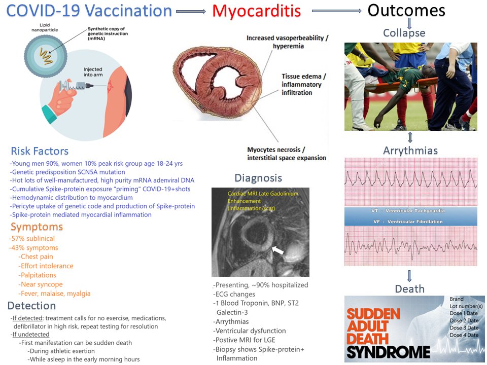 Myocardite vaccinale